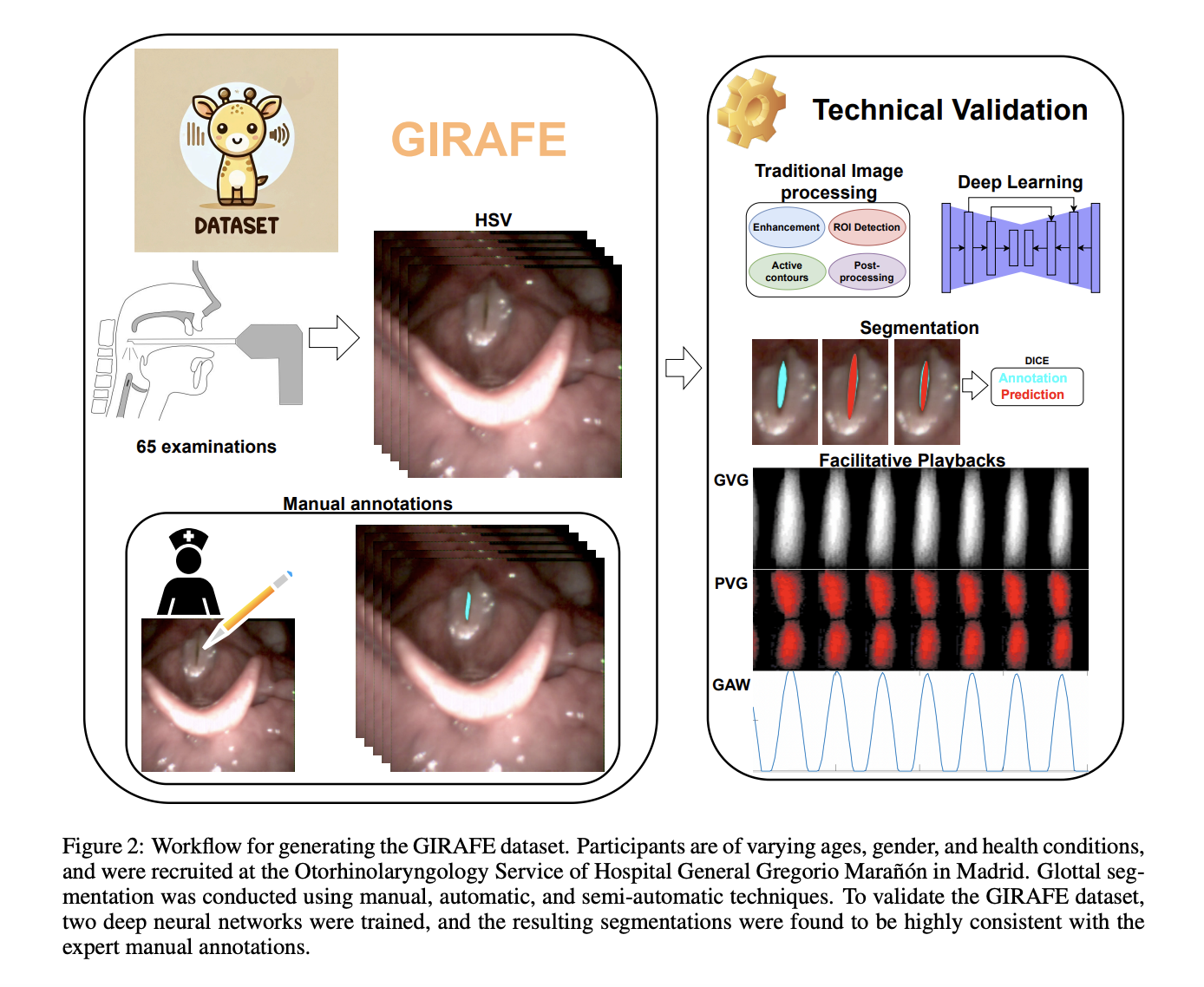 deep-learning-and-vocal-fold-analysis:-the-role-of-the-girafe-dataset