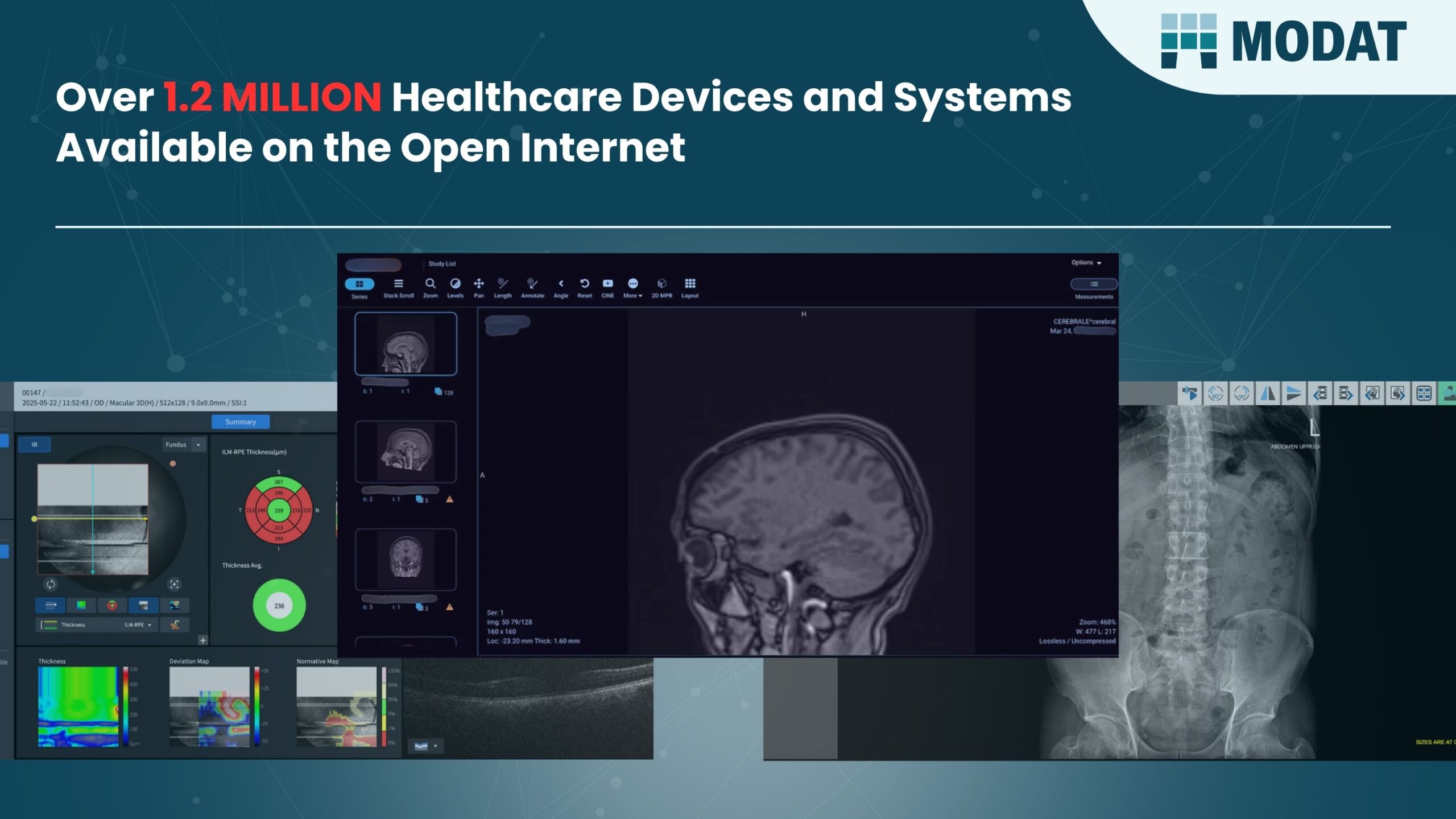 1.2-million-healthcare-devices-and-systems-found-exposed-online-–-patient-records-at-risk-of-exposure,-latest-research-from-modat