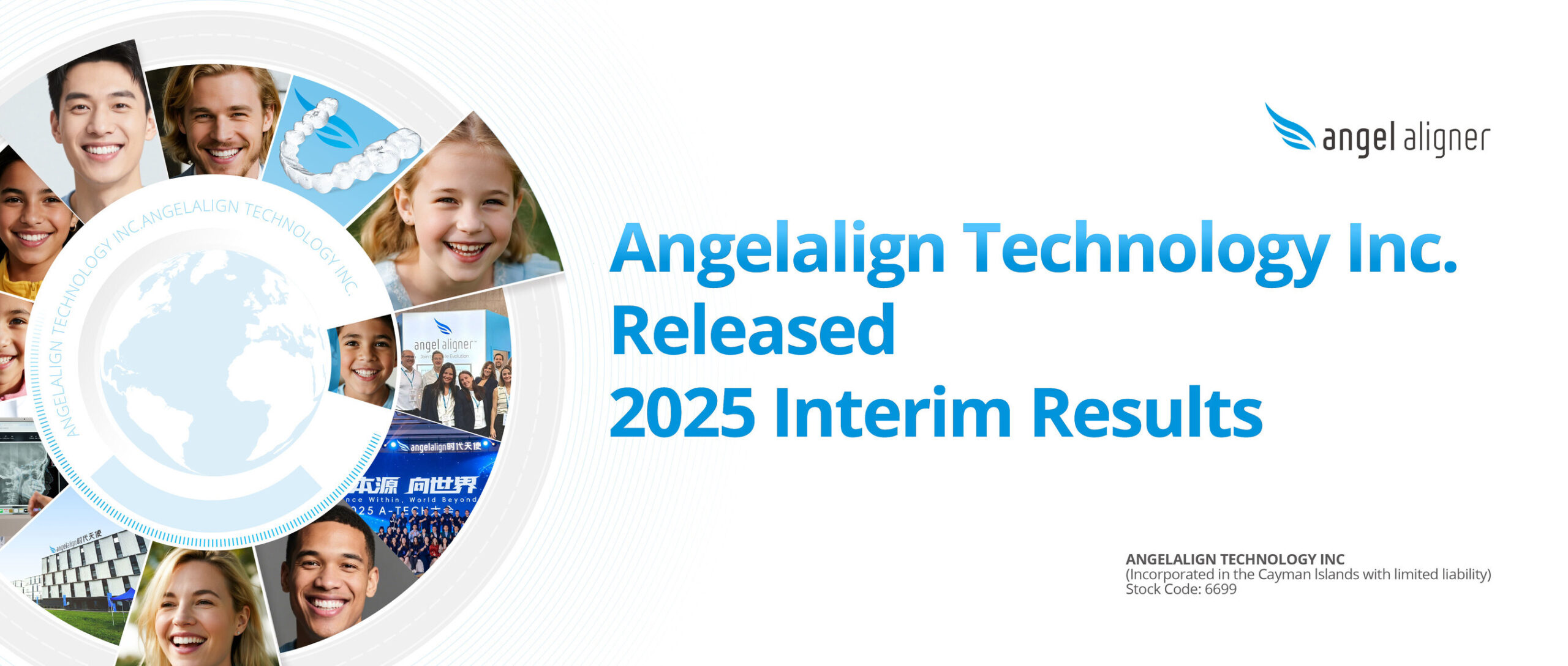angelalign-technology-announces-first-half-2025-results-while-increasing-investments-in-legal,-supply-chain-and-data-security