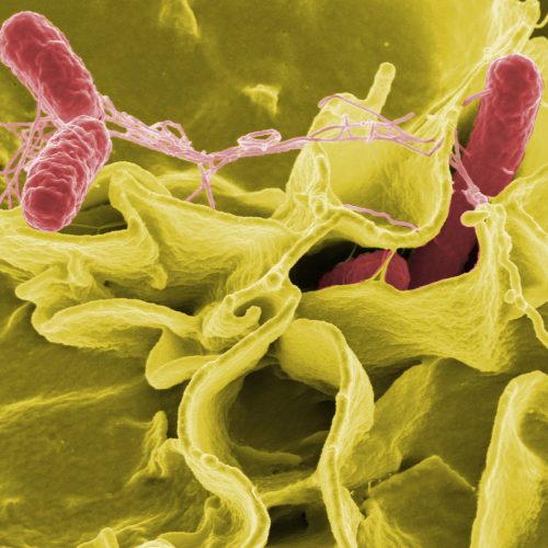 cdc-slashed-food-safety-surveillance,-now-tracks-only-2-of-8-top-infections
