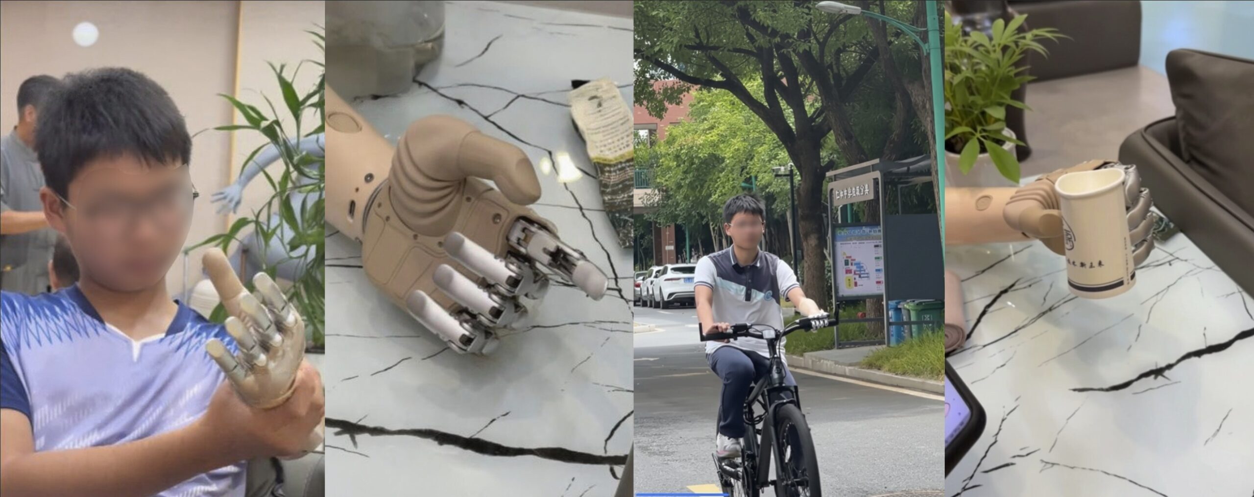 brainco-bionic-hand-inspires-a-child’s-journey-forward