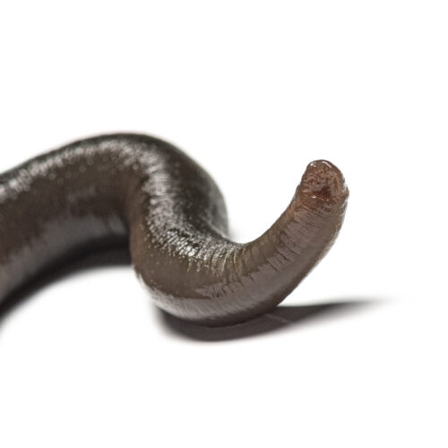 man-accidentally-gets-leech-up-his-nose-it-took-20-days-to-figure-it-out.