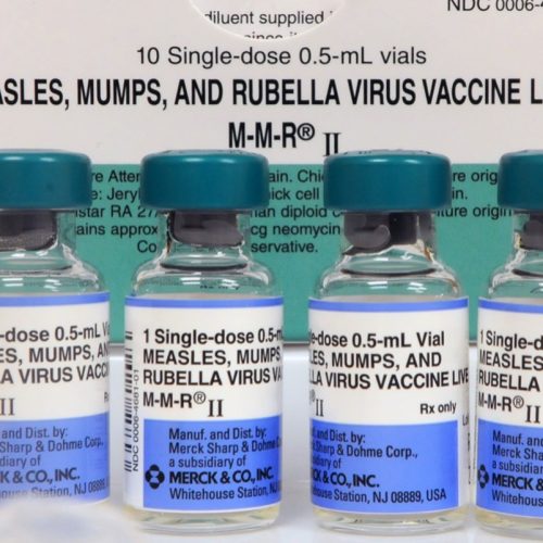SC measles outbreak has gone berserk: 124 cases since Friday, 409 quarantined