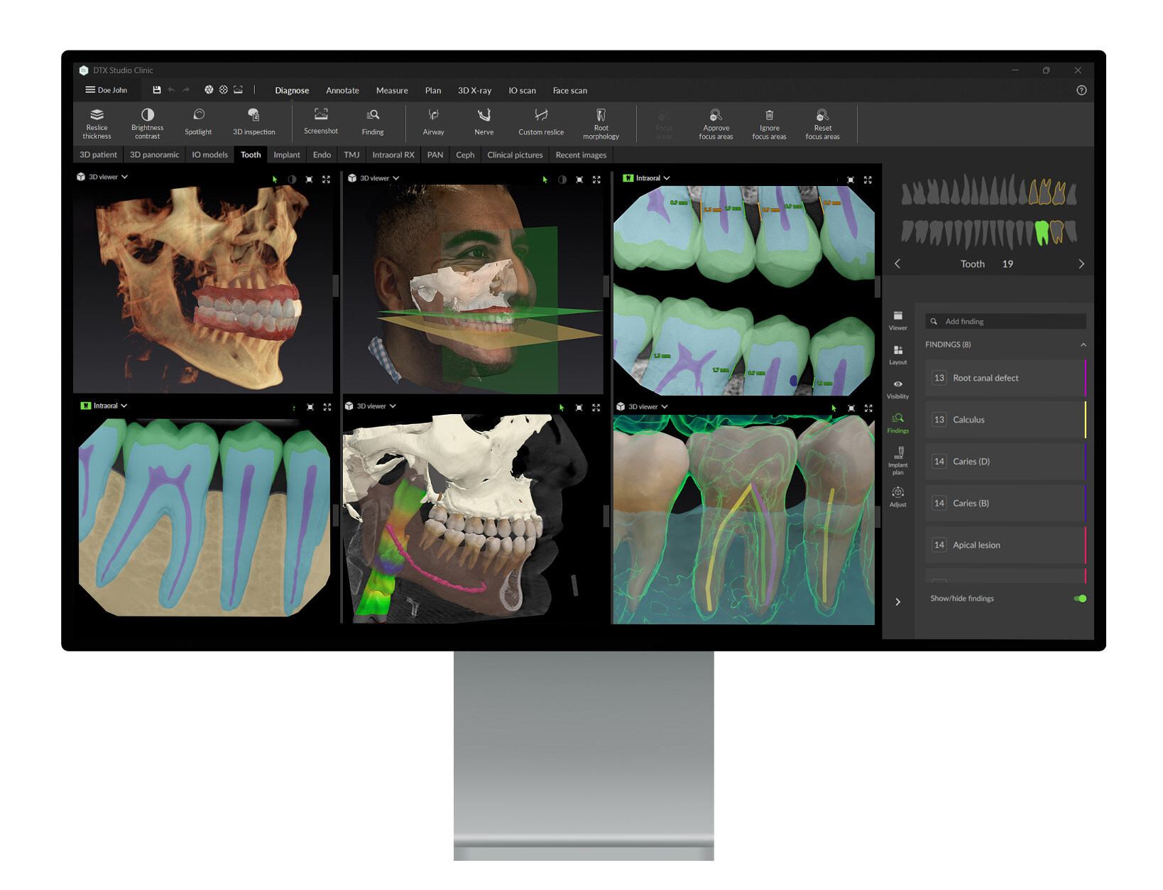 dexis-sets-a-new-benchmark-for-digital-dentistry-with-advanced-ai-and-seamless-connectivity