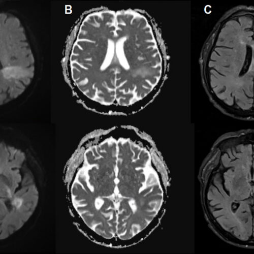 you’re-likely-already-infected-with-a-brain-eating-virus-you’ve-never-heard-of
