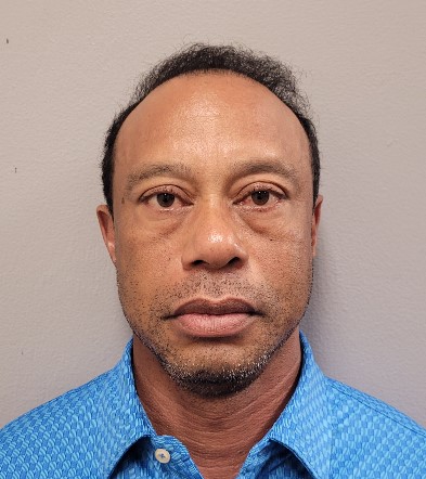 sweaty,-glassy-eyed-tiger-woods-blames-cell-phone-use-for-his-car-crash