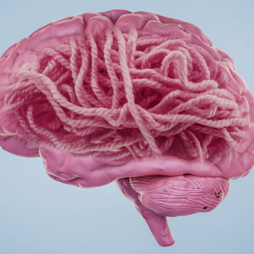 what’s-the-deal-with-alzheimer’s-disease-and-amyloid?