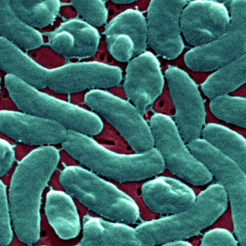 flesh-eating-bacteria-devour-man’s-arm-and-leg-in-just-three-days