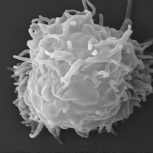 man-dies-covered-in-necrotic-lesions-after-amoebas-eat-him-alive