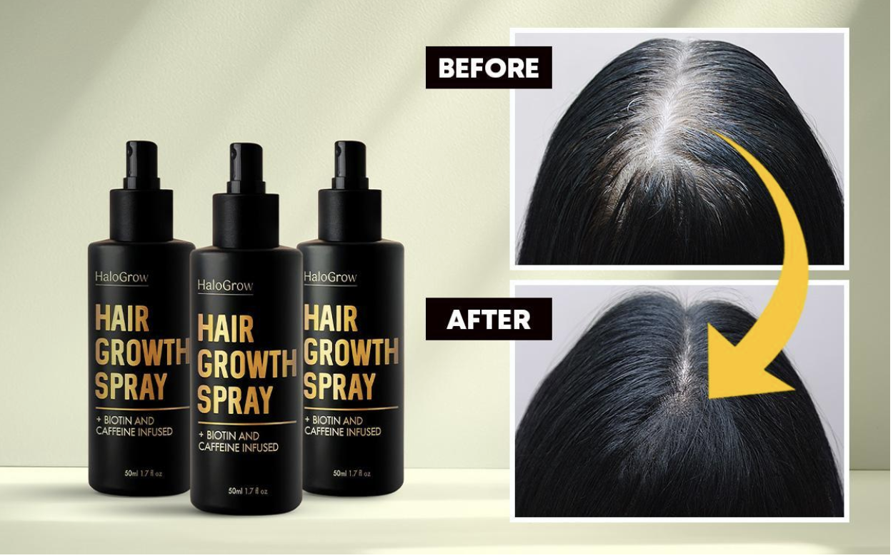 halogrow-analyzed:-why-is-halo-grow-hair-growth-spray-trending-in-the-united-states?