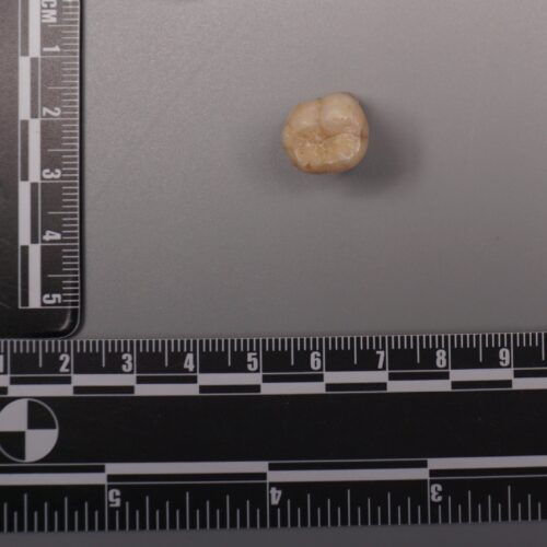 protein-in-homo-erectus-teeth-suggests-denisovans-gave-us-some-of-their-dna