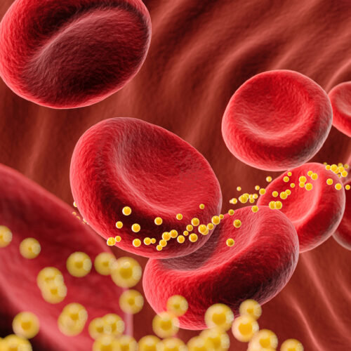 Bad cholesterol slashed 62% by single dose of gene-editing drug in small trial