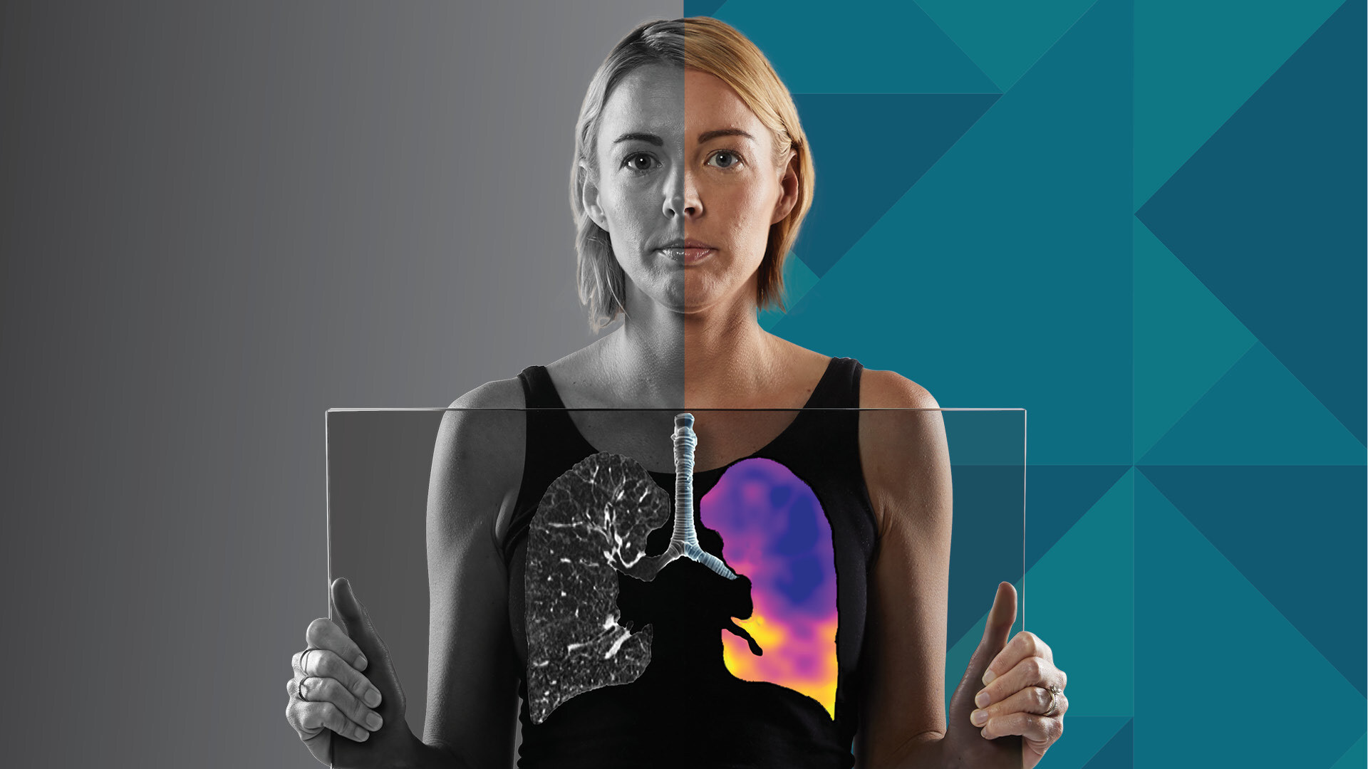 4dmedical-recibe-la-aprobacion-de-la-tga-para-ct:vq-y-su-introduccion-en-australia