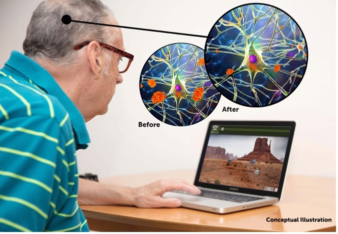 brain-training-shown-to-reduce-amyloid-indicative-of-alzheimer’s