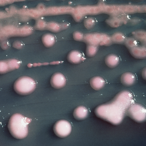 a-woman-got-a-uti-two-years-later,-the-bacteria-had-evolved,-invaded-her-brain.