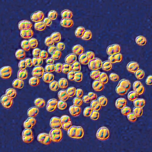 college-lab-class-ends-with-32-people-on-antibiotics-for-deadly-germ-exposure