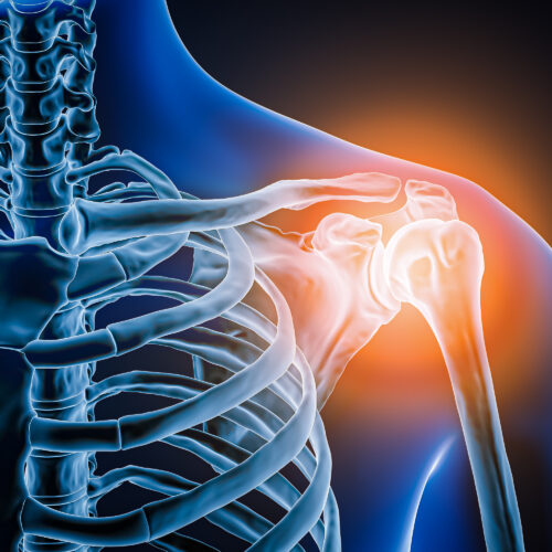 doctors-took-a-look-at-man’s-painful-shoulder—they-found-the-joint-was-missing