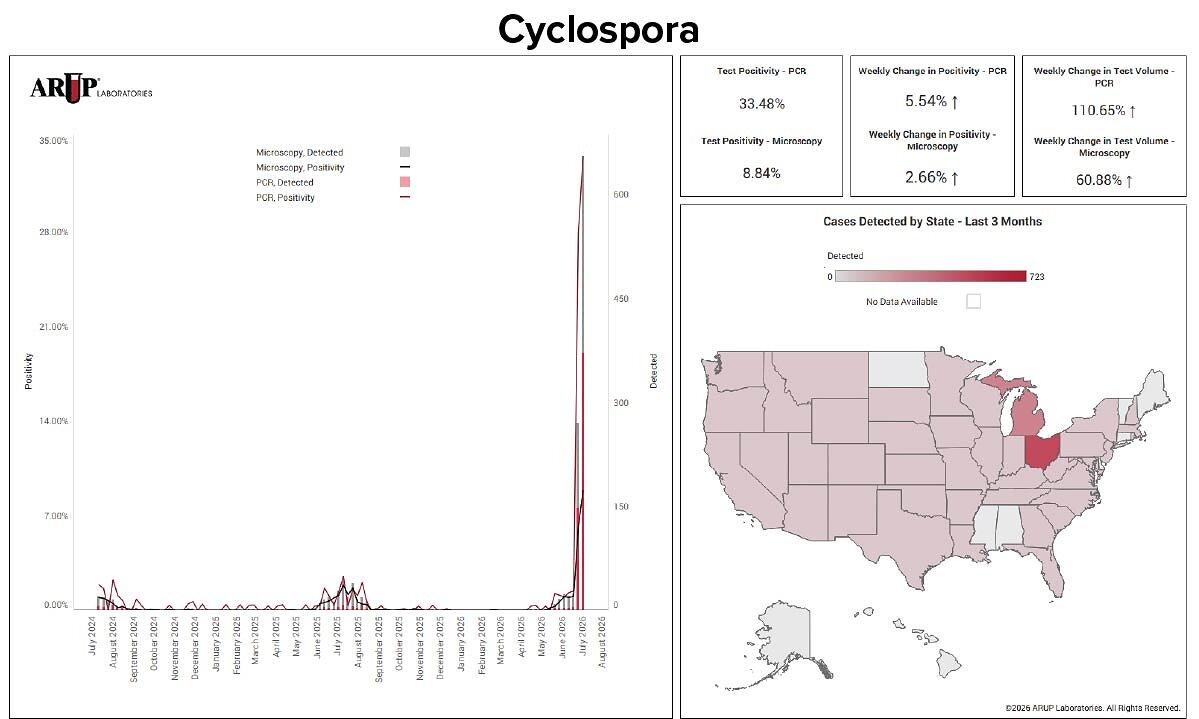 arup-laboratories-adds-cyclospora-data-to-infectious-disease-dashboard-amid-national-outbreak