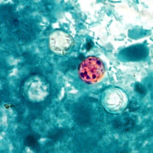trump-admin-shelves-cyclospora-research-despite-record-breaking-outbreak