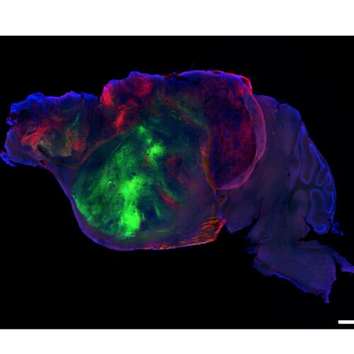researchers-swap-in-human-brain-cells-for-a-mouse’s-cortex