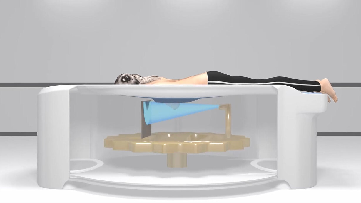 koning-health-announces-australian-regulatory-approval-for-koning-breast-ct-system
