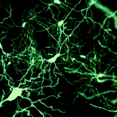 finding-the-cells-that-put-our-brain-to-sleep