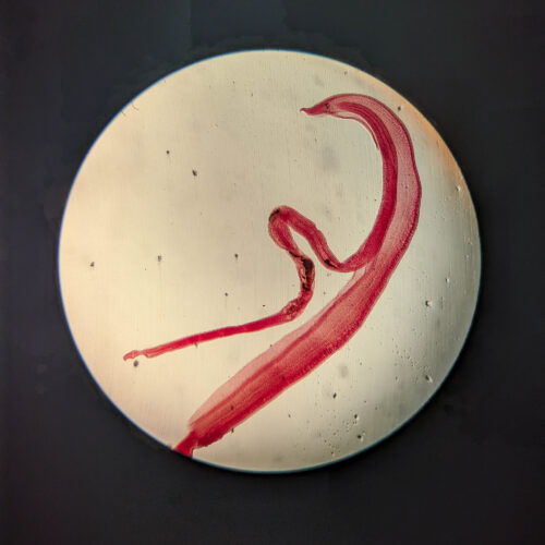 woman’s-brain-worm-infection-confirmed-after-eggs-grow-tails-in-lab-test